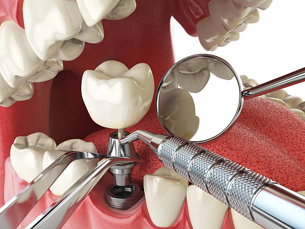 Best Cosmetic Emergency Dentistry in San Bernardino, CA
